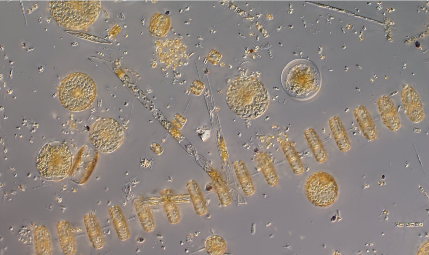 Фитопланктон дать определение. Фитопланктон нанопланктон зоопланктон. Фитопланктон водоросли. Фитопланктон под микроскопом. Фитопланктон хищники сапрофиты.